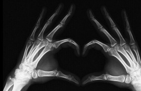 X-ray by Golan Levin (Flickr) X-ray by Golan Levin (Flickr)