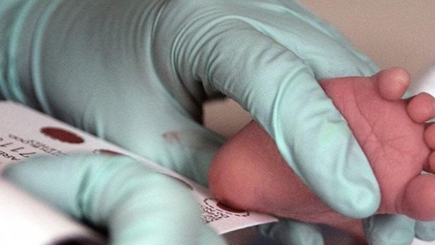ep al nacer se toman muestras de sangre de los recien nacidos y se utilizan para detectar