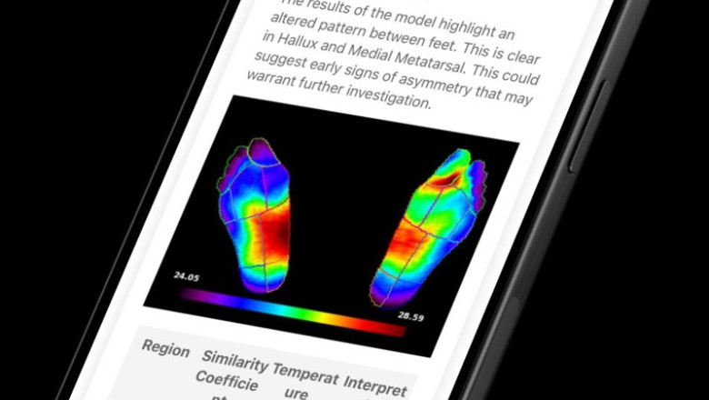 ep la sett invierte 650000 euros en clinicgram para impulsar su plataforma software sanitaria con ia ep la sett invierte 650000 euros en clinicgram para impulsar su plataforma software sanitaria con ia