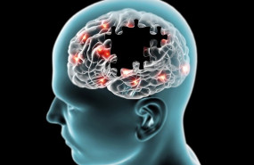 ep cerebro en la enfermedad de parkinson