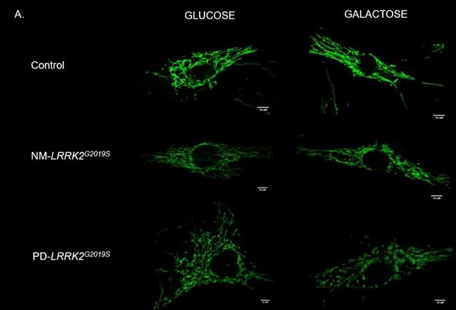 Gráfico del reto mitocondrial con Glucosa y Galactosa | UB ep graficoreto mitocondrialglucosagalactosa