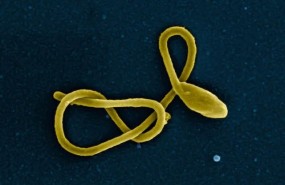 ep particulavirus del ebola