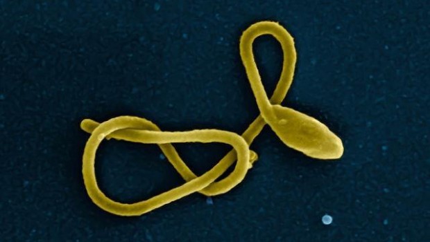 ep particulavirus del ebola