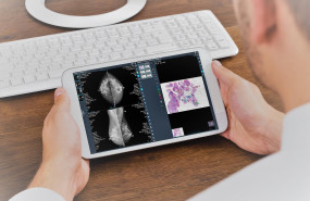 1594633371 visor apdedalus telefonica baja