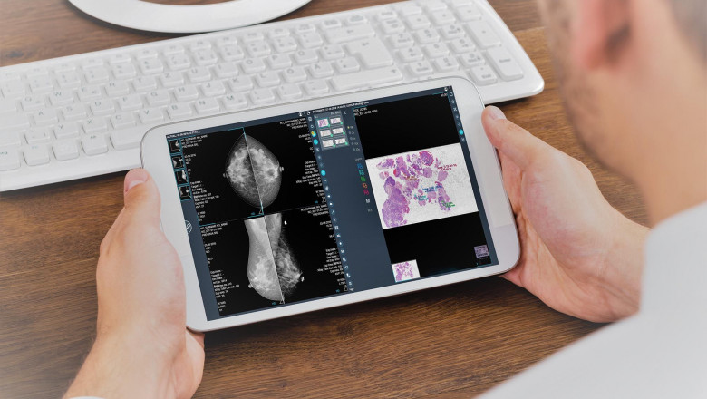 1594633371 visor apdedalus telefonica baja