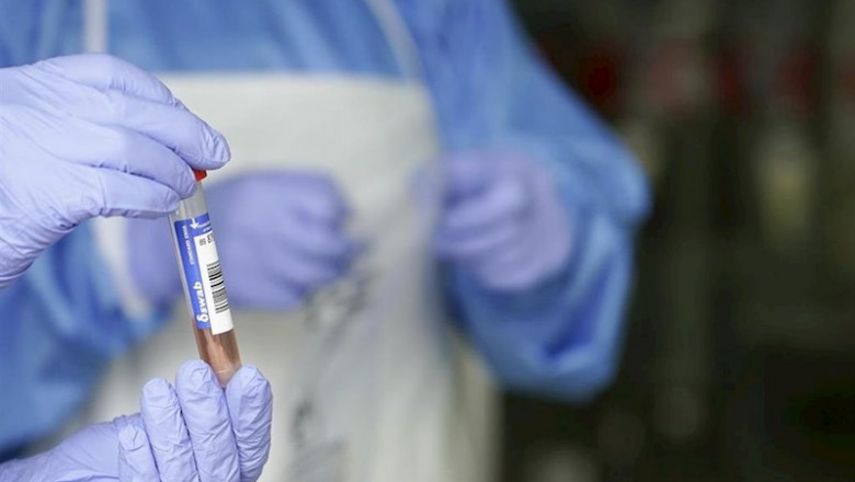 ep un sanitario protegido con guantes sostiene un muestra para realizar un analisis pcr en un local ep un sanitario protegido con guantes sostiene un muestra para realizar un analisis pcr en un local
