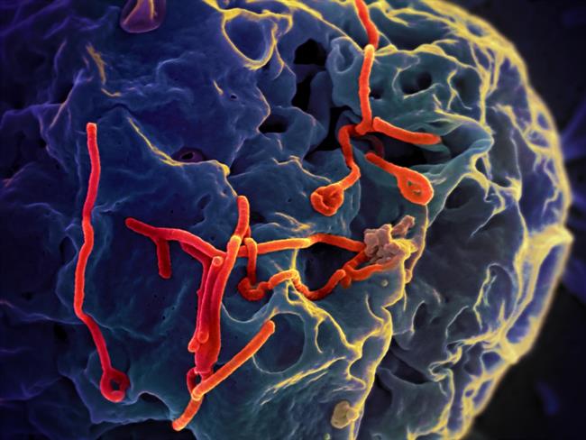 Virus del ébola. | ISGLOBAL ep virus del ebola