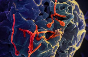 ep virus del ebola