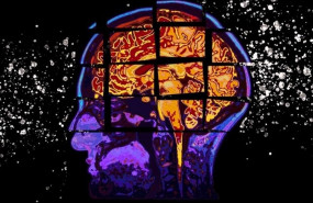 ep este modelo desarrolladomit predicedeclive cognitivolos pacientesriesgopadecerenfermedadalzheimerpronosticarpuntuacioneslas pruebascogniciondos anos antes