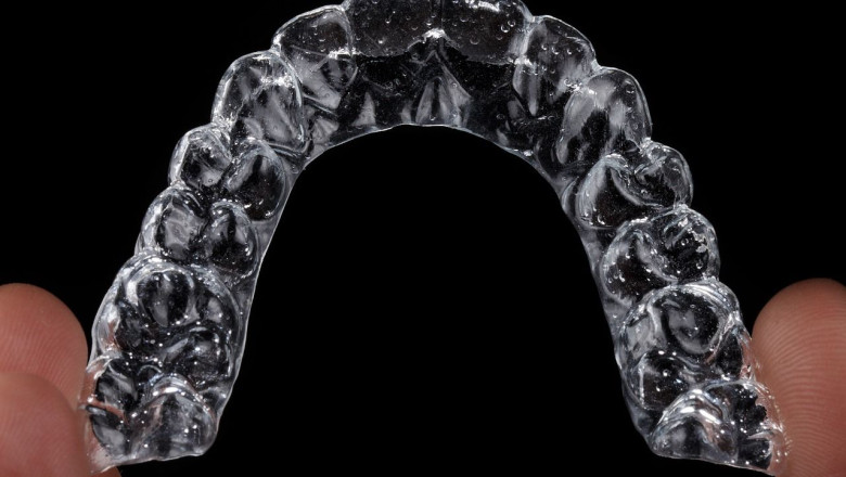 1238451 aligner 7169868 1280