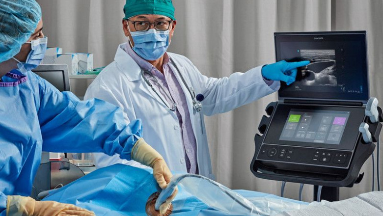 1598339056 tco eco grafo sonosite px uci