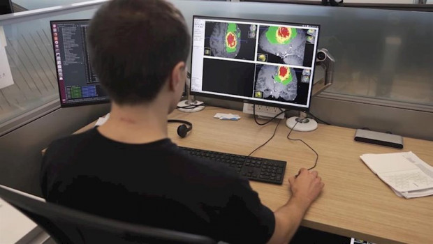 ep investigadores del kings college de londres usan la tecnologia de nvidia para identificar tumores