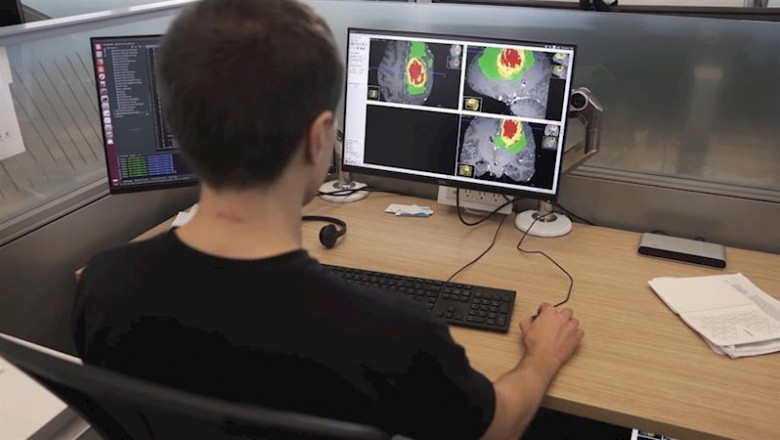 ep investigadores del kings college de londres usan la tecnologia de nvidia para identificar tumores