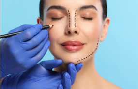 acibadem 1 20241219154708