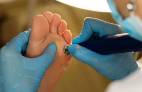 hongos verano en tamano grande