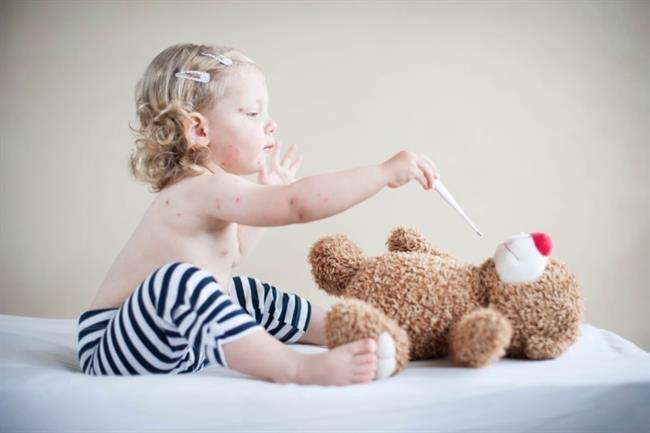 Sarampión, qué es, vacuna, síntomas | THINKSTOCK ep sarampion que es vacuna sintomas