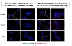 ep imagenes de grasa higado y piel de ratones adultos con telomeros normales y con telomeros