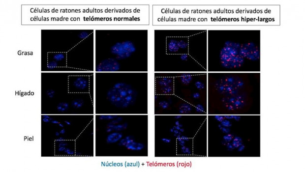 ep imagenes de grasa higado y piel de ratones adultos con telomeros normales y con telomeros