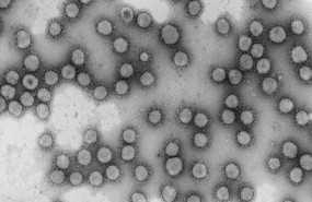 ep virus de la familia coronaviridae