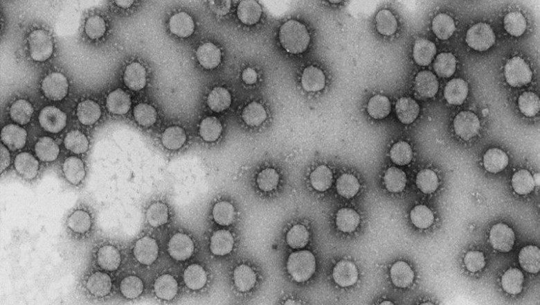 Virus de la familia Coronaviridae | CSIC ep virus de la familia coronaviridae