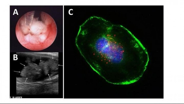 ep investigadores de estados unidos evidencian que el antrax puede ser eficaz para tratar el cancer