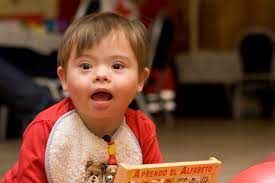 nio con sindrome de down nio con sindrome de down